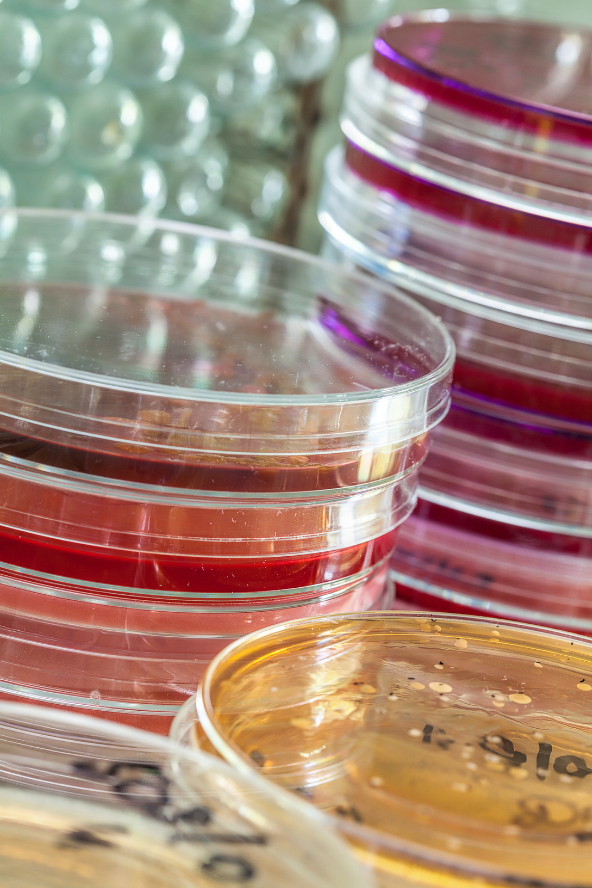 A stack of colourful petri dishes